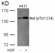 Anti-Phospho-HGFR/c-Met (Tyr1234) Polyclonal Antibody