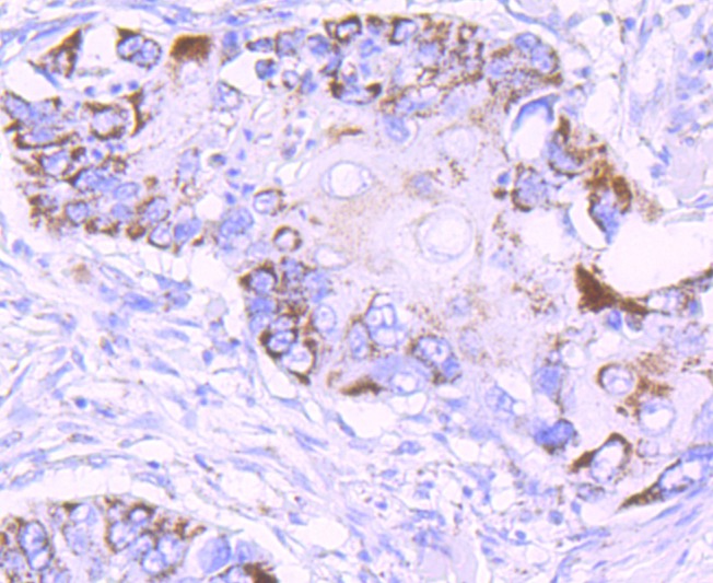 Anti-MMP-13 Antibody (2L744)
