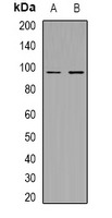Anti-Phospho-Mer/TYRO3 (Tyr753/685) Polyclonal Antibody