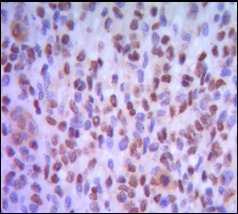 Anti-IRF4 Antibody (7S662)