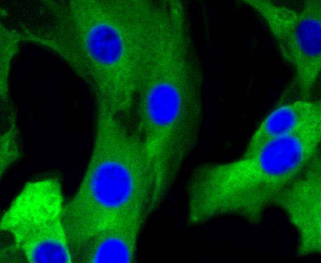 Anti-GRM5 Antibody (8K741)