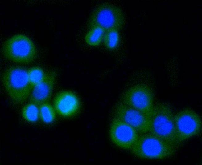 Anti-MMP-14 Antibody (7I45)