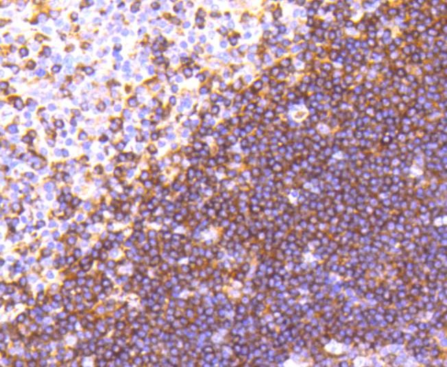 Anti-Moesin Antibody (2Z70)
