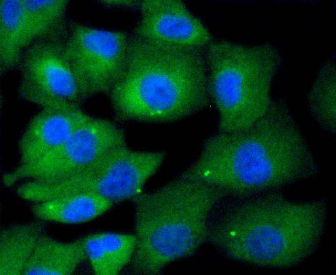 Anti-MKLP1 Antibody (7V592)