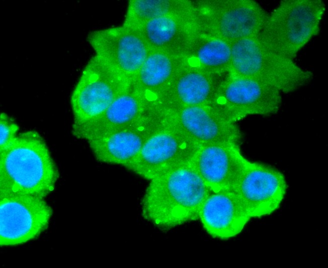 Anti-Mucin-16/MUC16 Antibody (2J784)