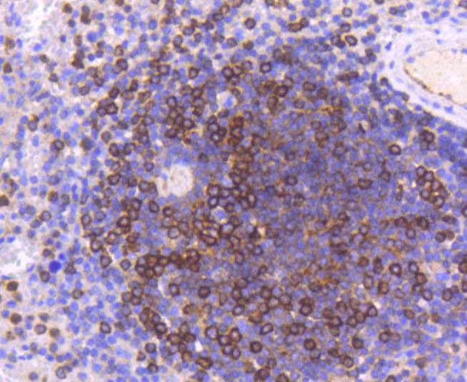 Anti-Moesin Antibody (2Z70)