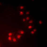 Anti-Phospho-MKI67IP (Thr234) Polyclonal Antibody