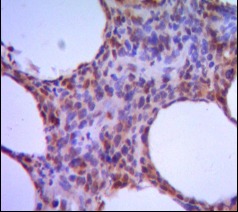 Anti-IRF4 Antibody (7S662)