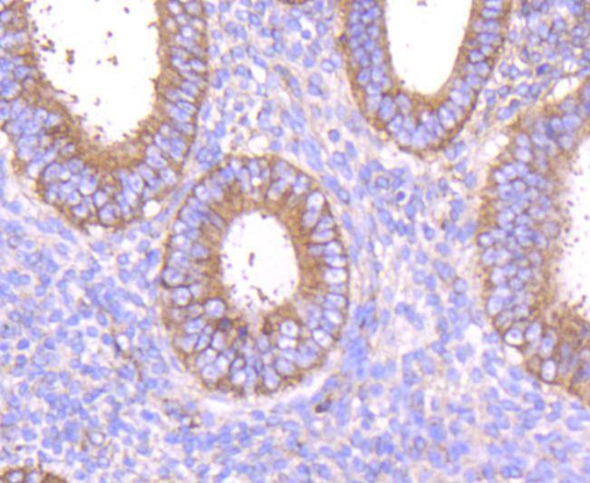 Anti-MMP-14 Antibody (7I45)
