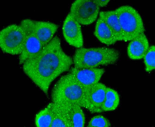 Anti-MAP3K3 Antibody (2Q519)