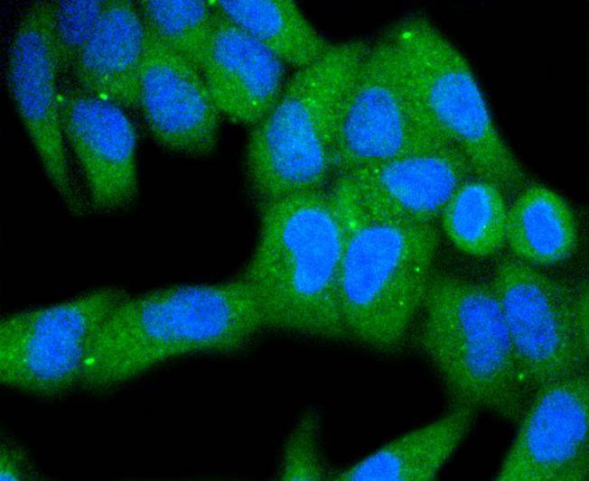 Anti-MKLP1 Antibody (7V592)