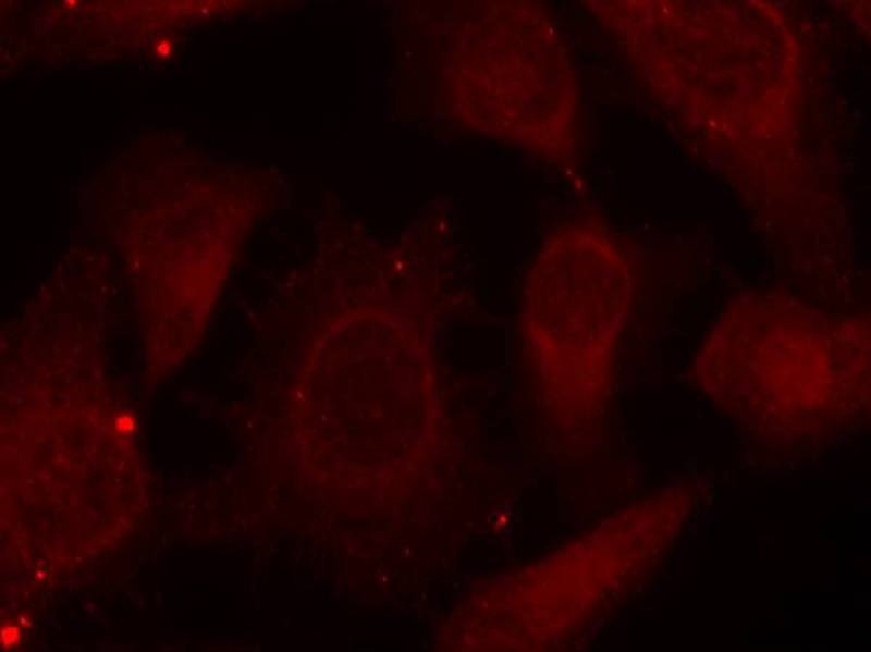 Anti-Phospho-Merlin (Ser518) Polyclonal Antibody 2