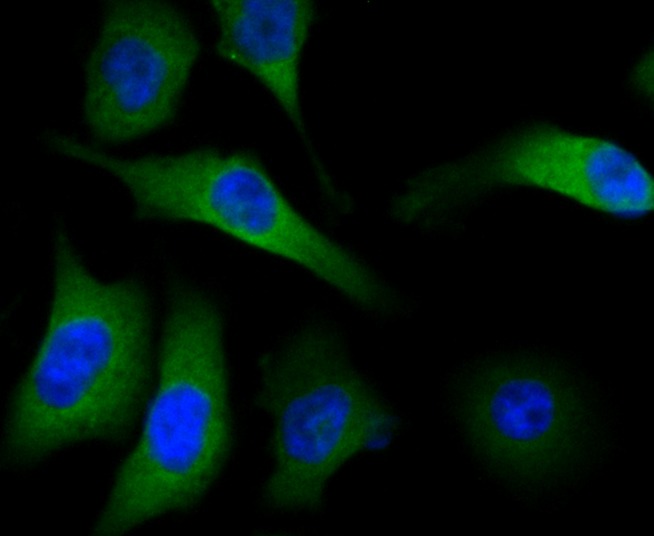 Anti-METAP2 Antibody (2D279)