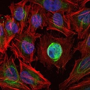Anti-MMP-1 Antibody (1H680)