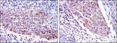 Anti-MMP-1 Antibody (1H680)