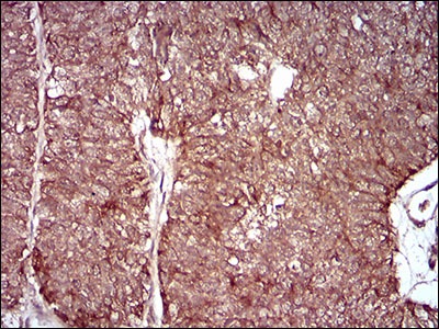Anti-MMEL1 Antibody (9N137)