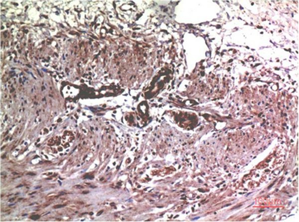 Anti-MMP-2 Antibody (5L604)