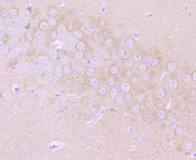 Anti-MMP17 Antibody (1E489)