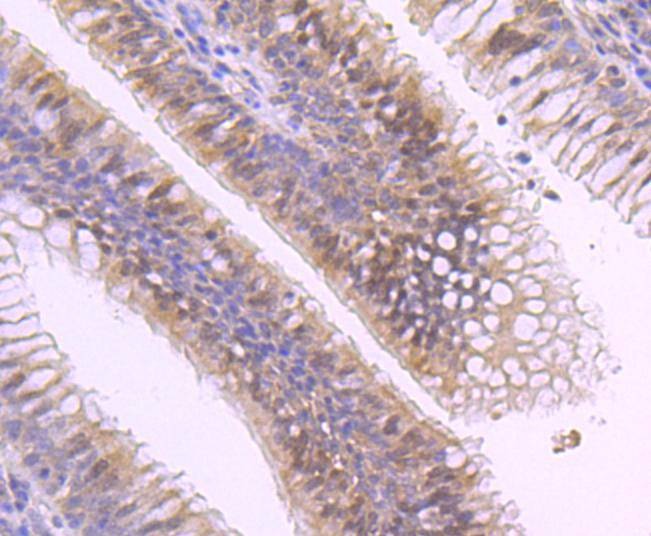 Anti-MGMT Antibody (6G140)