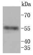 Anti-MMP11 Antibody (2X863)