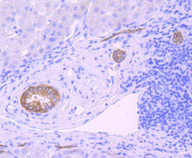 Anti-Midkine Antibody (9Z235)