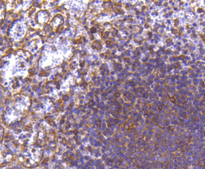 Anti-MMP11 Antibody (2X863)