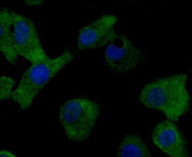 Anti-MMP17 Antibody (1E489)