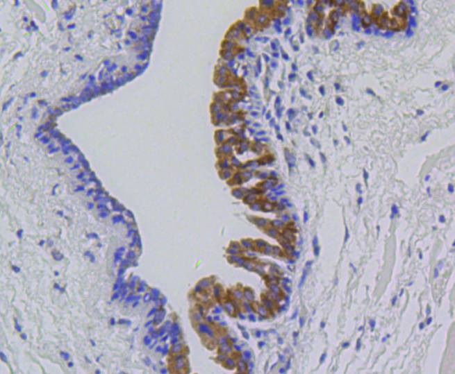 Anti-MMP-12 Antibody (1B615)