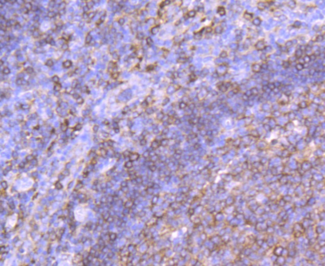 Anti-HLA-DPB1 Antibody (7X876)