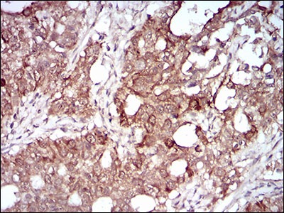 Anti-MMEL1 Antibody (9N137)