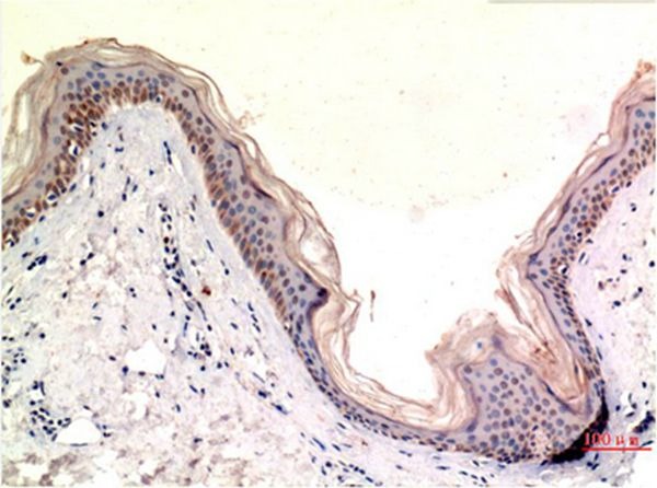 Anti-MLKL Antibody (6M900)
