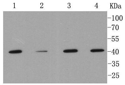 Anti-MMP-12 Antibody (1B615)