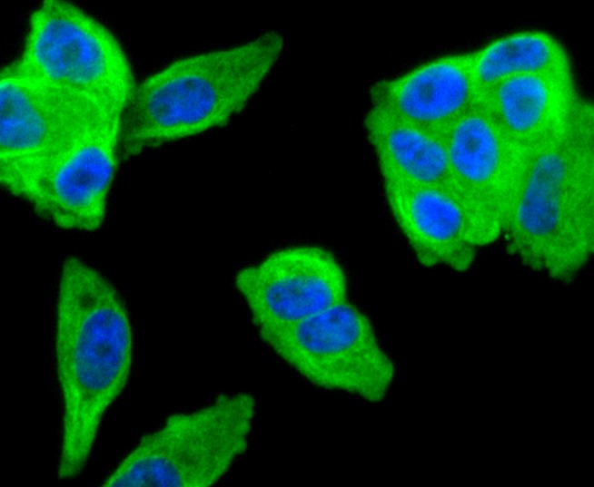 Anti-MMP11 Antibody (2X863)