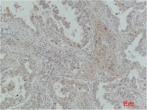 Anti-MICU1 Antibody (8Q445)