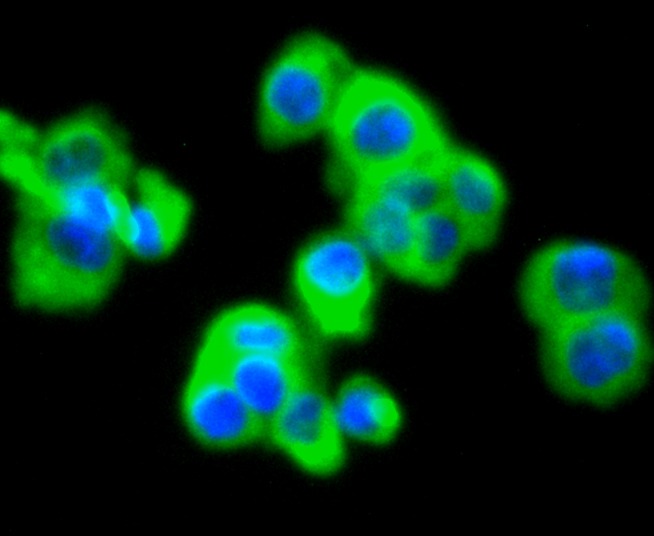 Anti-MMP11 Antibody (2X863)