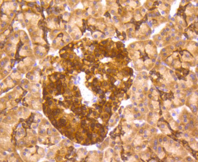 Anti-MSI2 Antibody (1Q704)