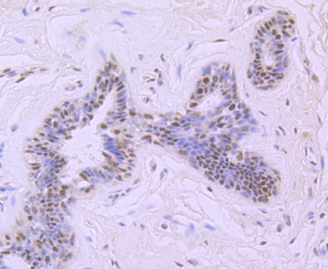 Anti-MRE11 Antibody (6B152)