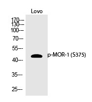 Anti-Phospho-OPRM1 (Ser375) Polyclonal Antibody 2