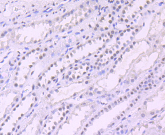Anti-SIN3A Antibody (9Z567)