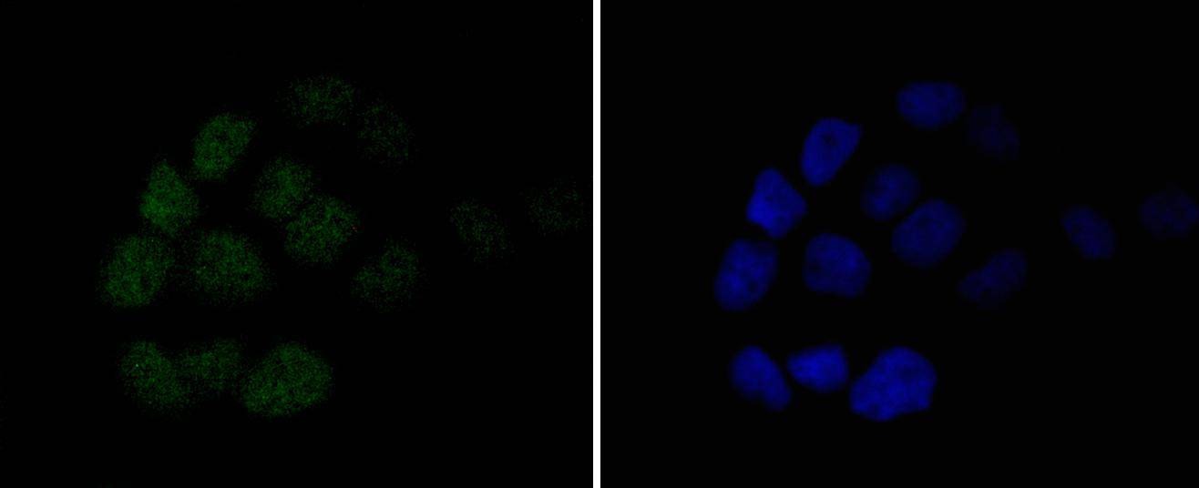 Anti-MSH6 Antibody (6V732)