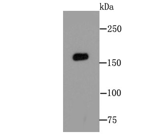 Anti-MSH6 Antibody (3L662)