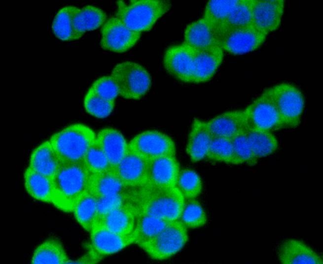Anti-MSI2 Antibody (1Q704)