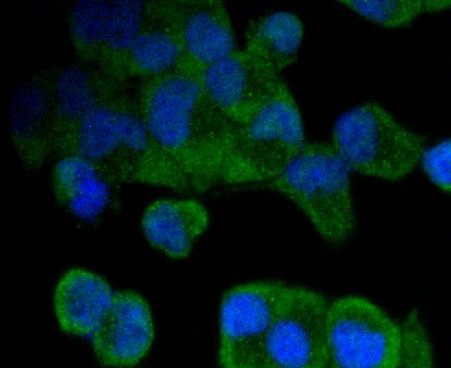 Anti-MSI2 Antibody (1Q704)