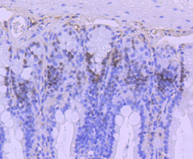 Anti-MSH6 Antibody (6V732)
