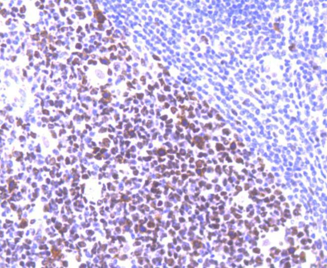 Anti-MSH6 Antibody (6V732)