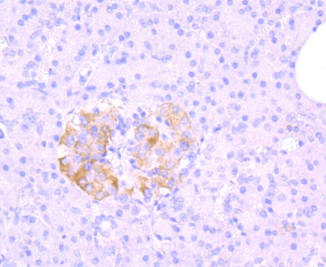 Anti-ABCC1 Antibody (2I585)