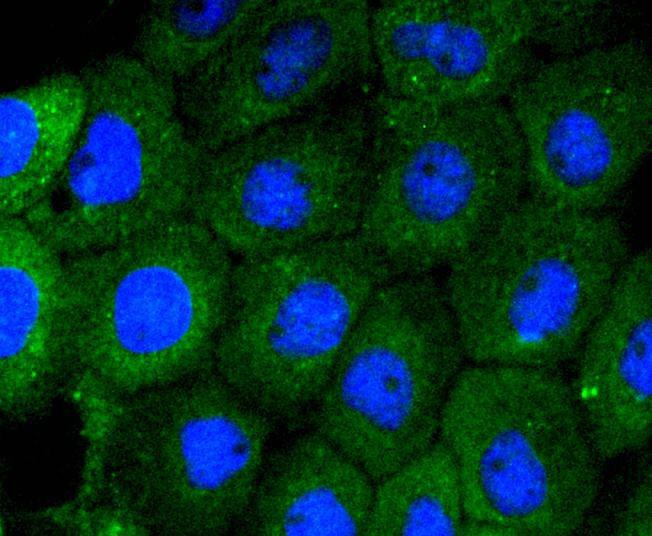 Anti-MEK5 Antibody (4P780)