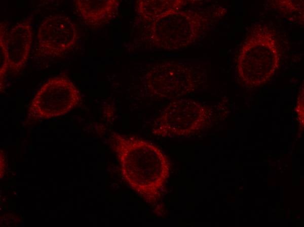 Anti-Phospho-mTOR (Ser2448) Polyclonal Antibody 2
