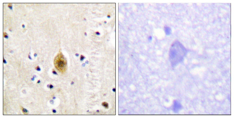 Anti-Phospho-MST1 (Thr183) Polyclonal Antibody 2