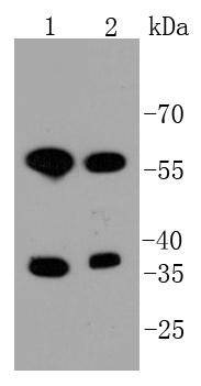 Anti-STK3 Antibody (1D681)